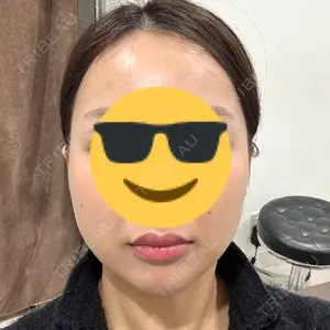 TCB東京中央美容外科 渋谷西口院口コミ