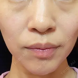 DMTC美容皮膚科 大宮院口コミ