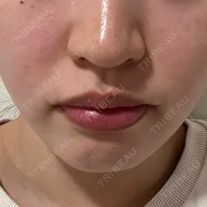 EMMO FACE CLINIC 東京三田院口コミ