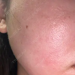 DAILY SKIN CLINIC 新宿院口コミ