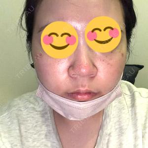 ルラ美容クリニック 神戸院口コミ
