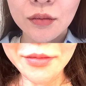 DAILY SKIN CLINIC 心斎橋院口コミ
