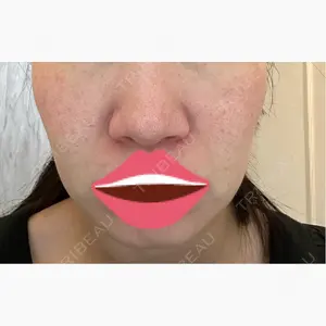 DAILY SKIN CLINIC 新宿院口コミ