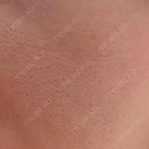 ライズワン美容皮膚科クリニック口コミ