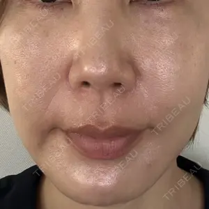 TCB東京中央美容外科 宇都宮院口コミ