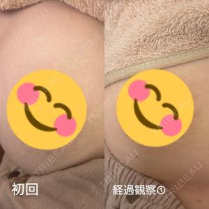 銀座マイアミ美容外科口コミ