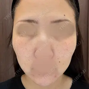 錦美容クリニック口コミ