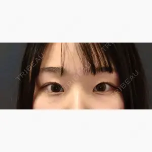 NARU Beauty Clinic 【ナルクリ】口コミ