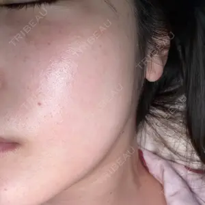 やさしい美容皮膚科・皮フ科　東京浅草院口コミ