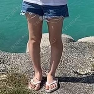 銀座マイアミ美容外科口コミ