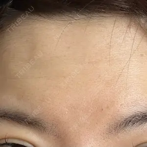TCB東京中央美容外科 宇都宮院口コミ