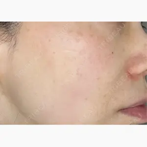 ルラ美容クリニック 上野院口コミ