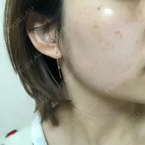 UB CLINIC銀座口コミ
