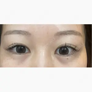 LIFIX BEAUTY CLINIC口コミ