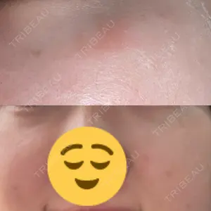 DAILY SKIN CLINIC 福岡院口コミ