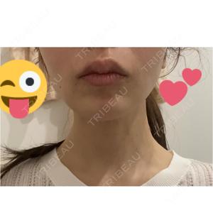 BELINDA CLINIC（ベリンダクリニック）岡山院口コミ