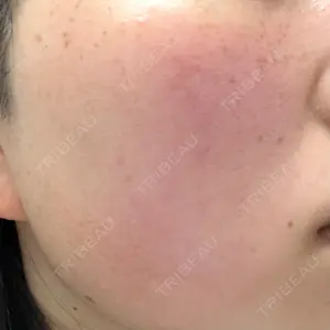 ルラ美容クリニック 神戸院口コミ