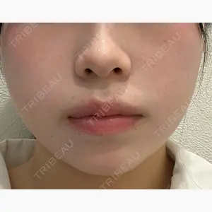 Leap beauty clinic口コミ