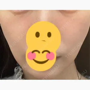ルラ美容クリニック 京都院口コミ
