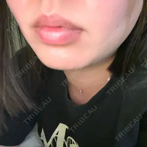 MIO CLINIC 梅田院口コミ
