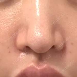 Zetith Beauty Clinic 福岡院口コミ