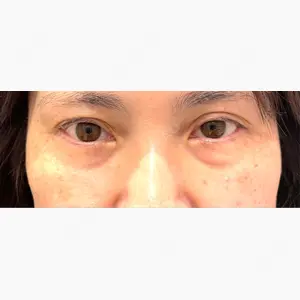 R Beauty CLINIC 名古屋院口コミ