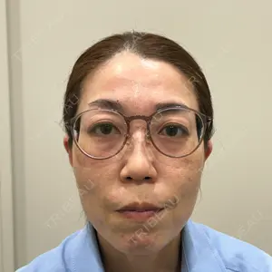 ノエル銀座クリニック口コミ