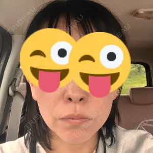TCB東京中央美容外科 つくば院口コミ