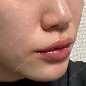 スマートスキンクリニック 横浜院口コミ