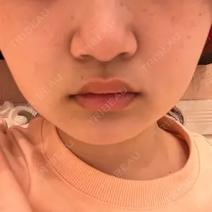 A CLINIC（エークリニック） 池袋院口コミ