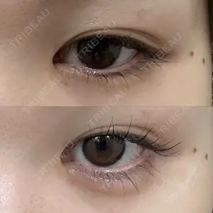 フィラークリニック 新宿院口コミ