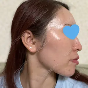 千葉美容外科アイビークリニック口コミ