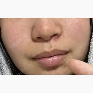 広島本通り美容クリニック口コミ