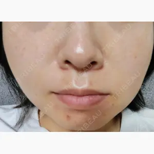 ルラ美容クリニック 宇都宮院口コミ