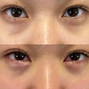 BELINDA CLINIC（ベリンダクリニック）新宿院口コミ