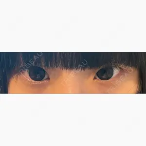 AYANAフィラーズクリニック 渋谷院口コミ