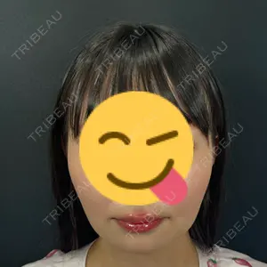 東京シンデレラ美容外科 池袋院口コミ