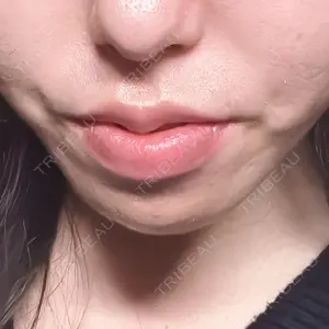 KIHARU CLINIC口コミ