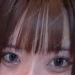東京シンデレラ美容外科 大宮院口コミ