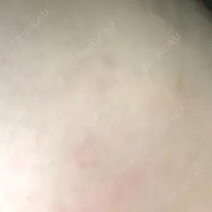 MIO CLINIC 梅田院口コミ