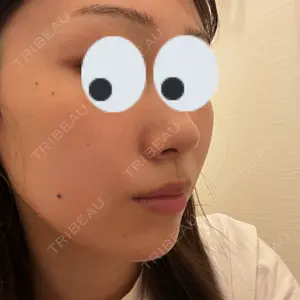 ケセラクリニック口コミ