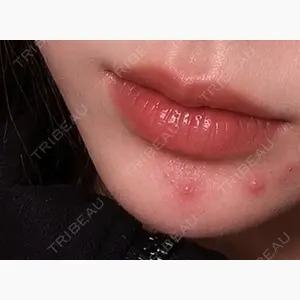 KM新宿クリニック口コミ