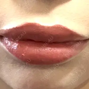 ルラ美容クリニック 沖縄院口コミ