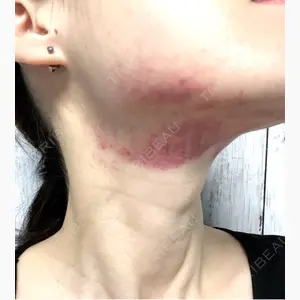 Moon Beauty Clinic口コミ