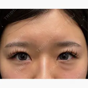 ネビュラクリニック 京都院口コミ