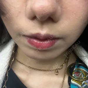 ルラ美容クリニック 渋谷本院口コミ