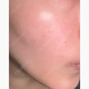 ルラ美容クリニック 京都院口コミ