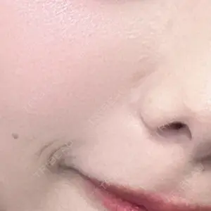メディカルアルファクリニック口コミ