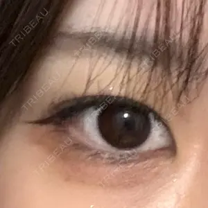 BITO BEAUTY CLINIC口コミ