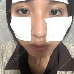 小倉美容外科ネビュラクリニック口コミ